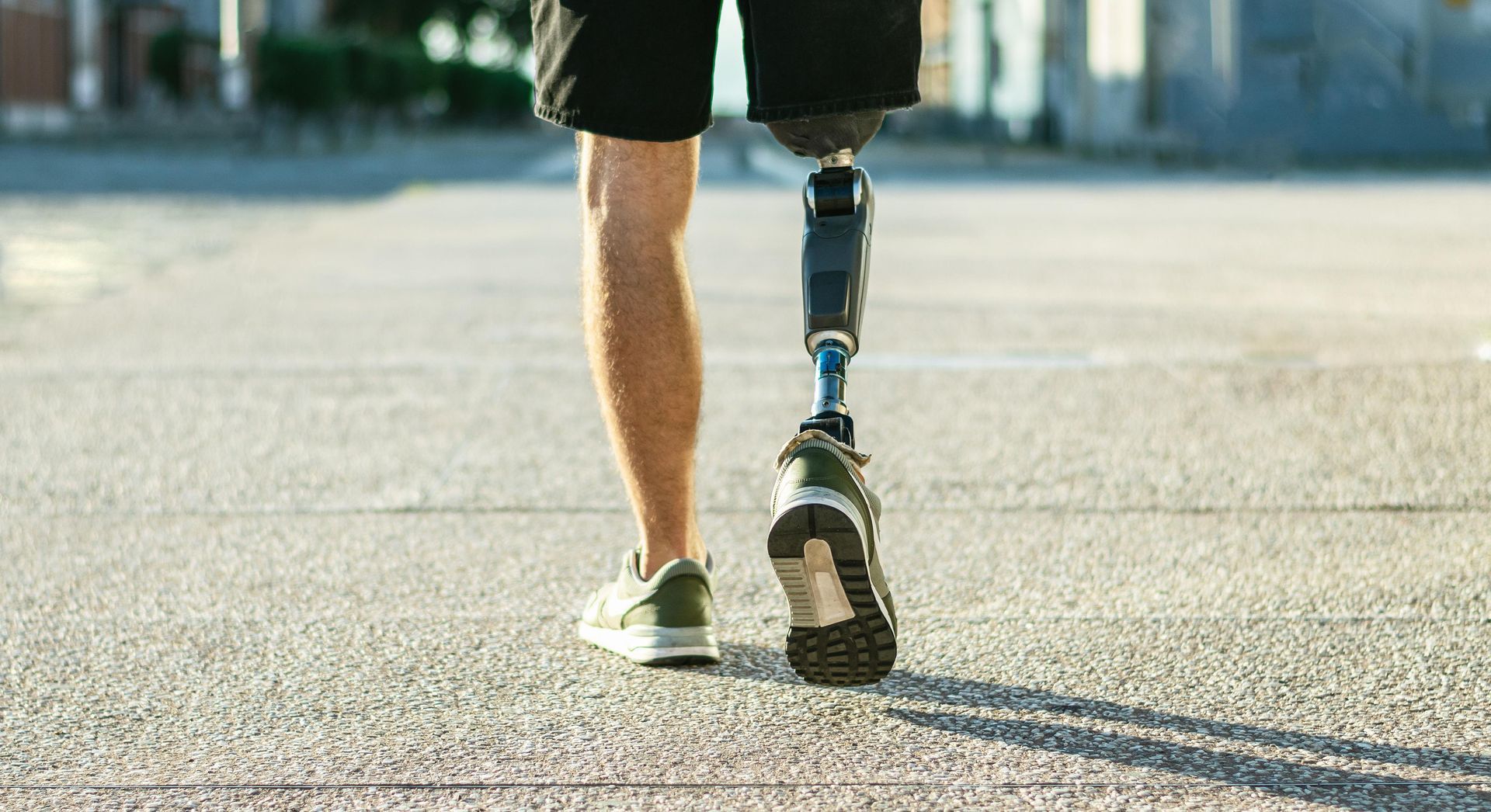Prosthetics
