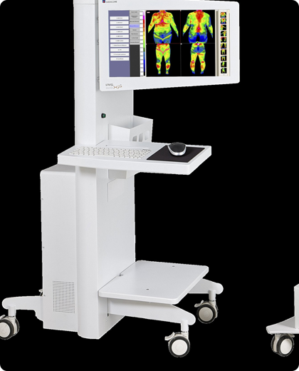 Medical cart with monitor displaying thermal body scans, white with wheels.