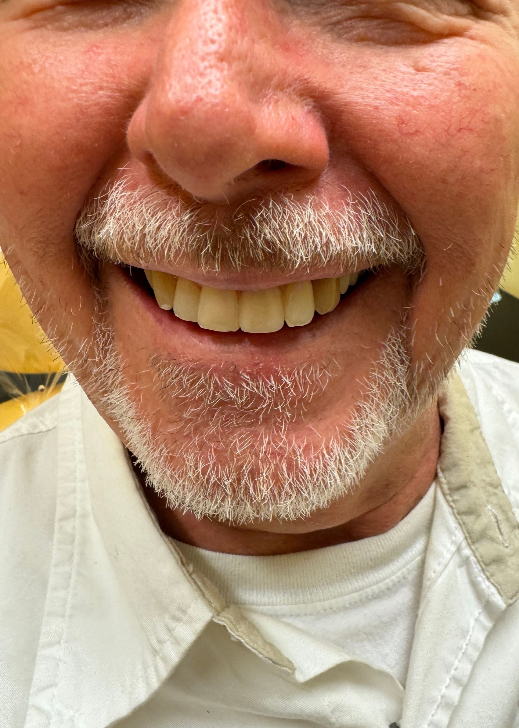 Close-up of a smiling person with a gray mustache and beard, showing a bright, even set of teeth.