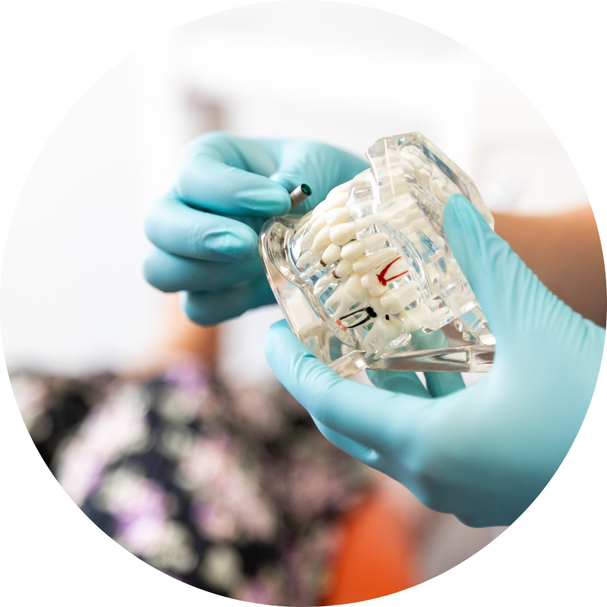Hands in blue gloves holding a clear dental model with teeth, in front of a blurred patient.