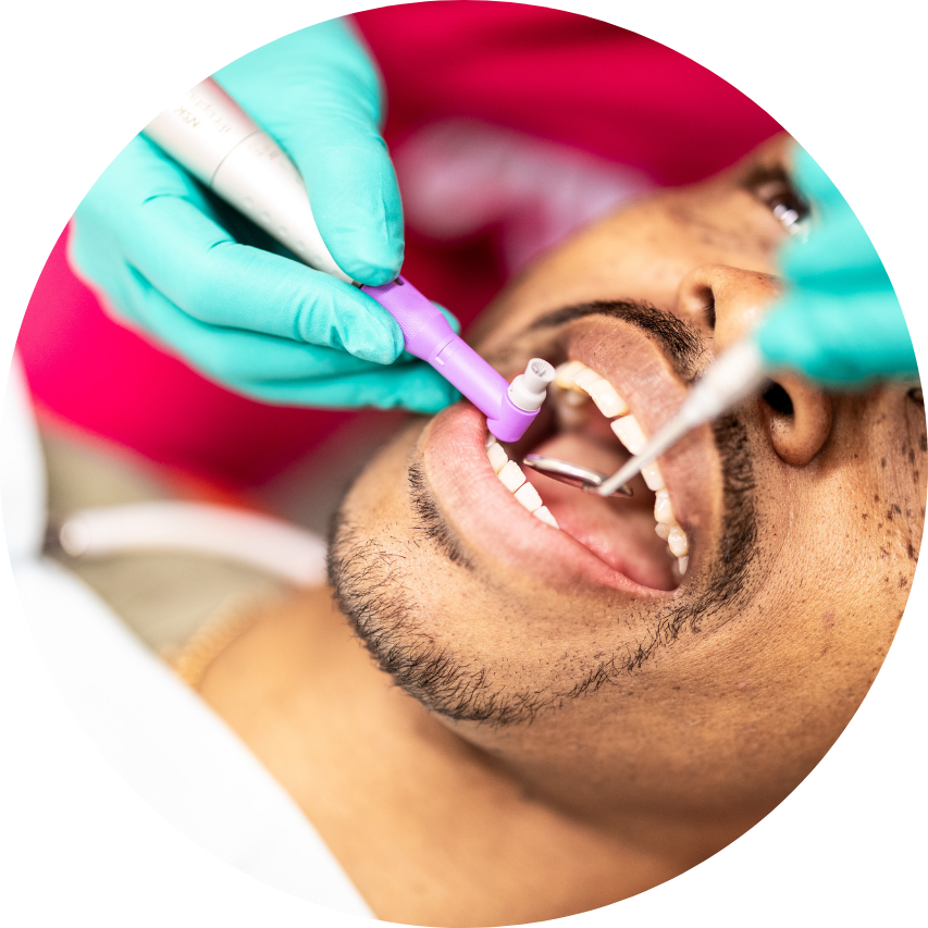 Dental cleaning in progress; gloved hands holding tools; patient's mouth open.