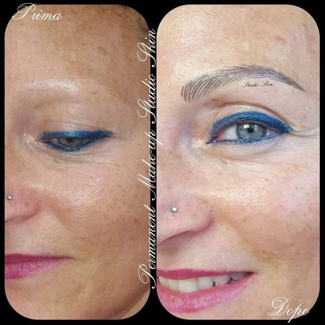 Trattamento di estetica oncologica