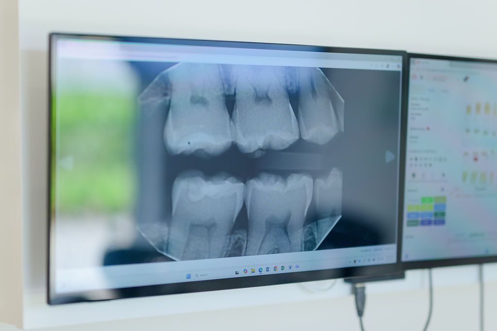 Close view of dental X rays on a screen during treatment planning