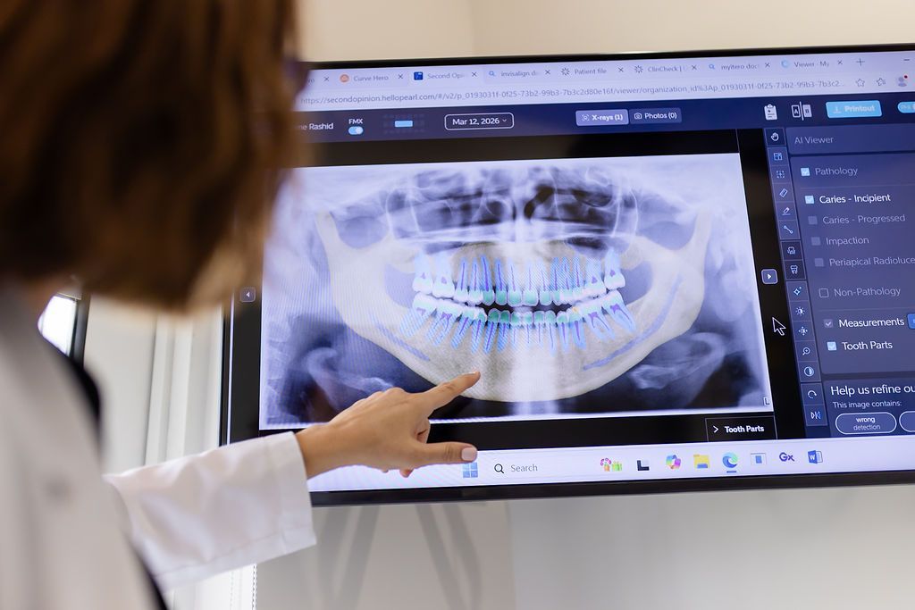 Dentist pointing to a panoramic X ray to plan an implant site