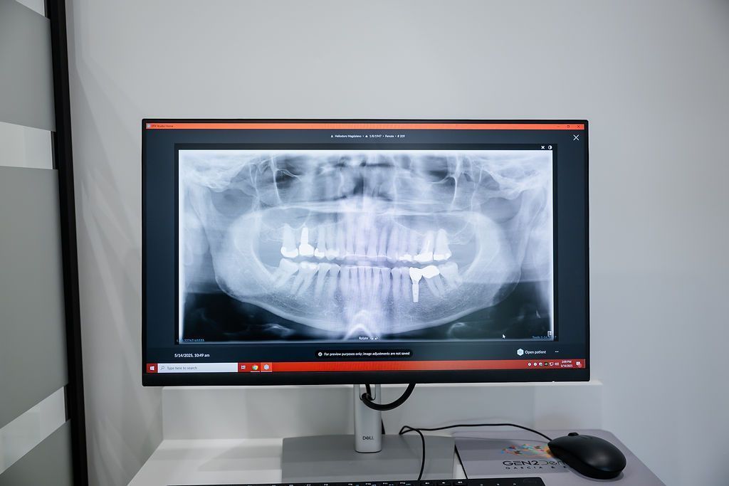 Panoramic dental X ray on a monitor used to plan bone grafting