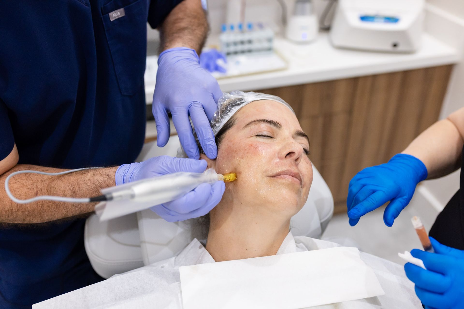 Dr. Paul Garcia doing PRF microneedling with a DermaPen in Davie, FL