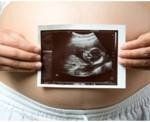 Pregnant (2)