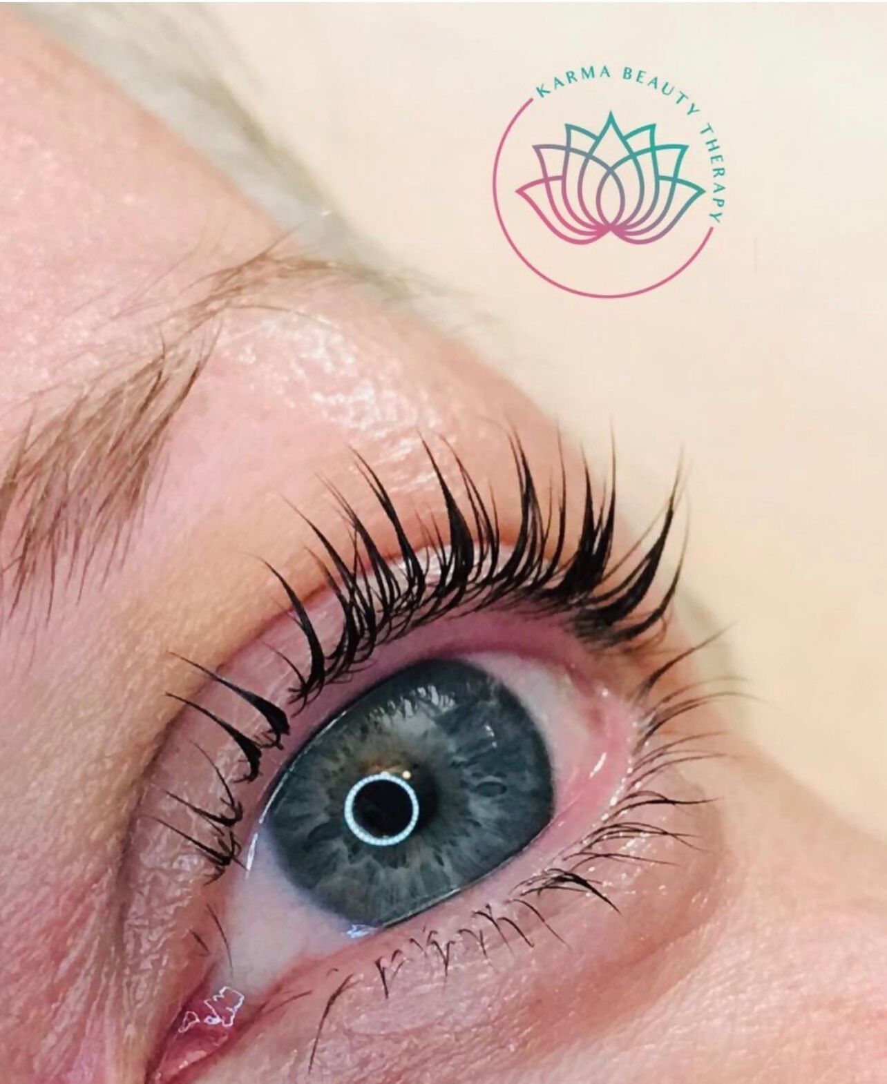 eye treatment