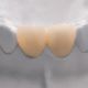 Z Crown Anterior