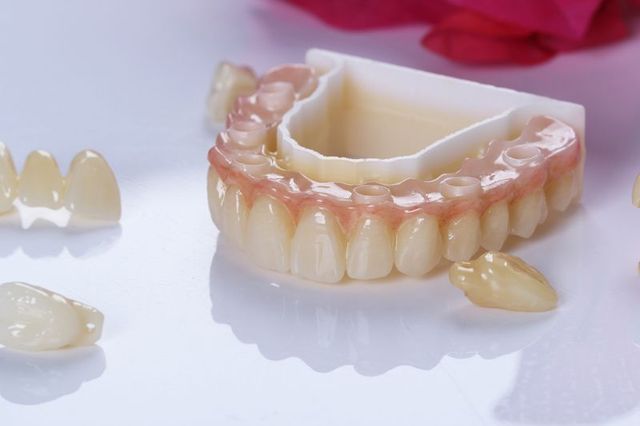 crowns Z Crown Zirconia Crowns & Bridges | Bayshore Dental Studio