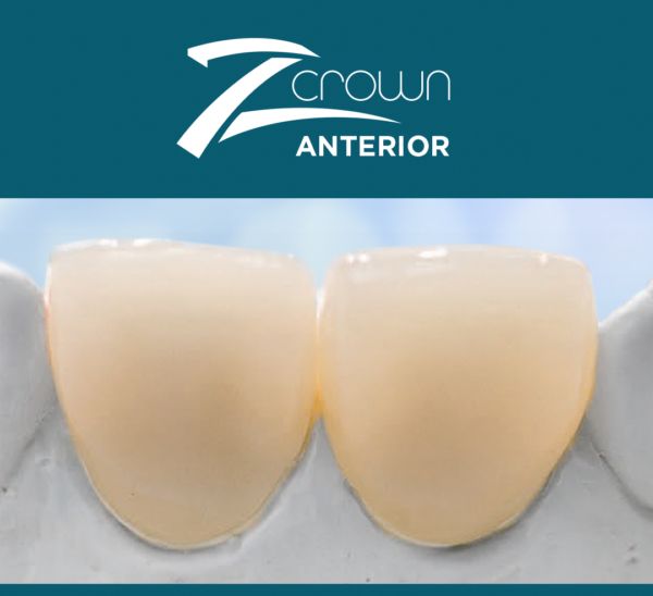 Z Crown Anterior is perfect for Anteriors, but strong enough for Posteriors.
