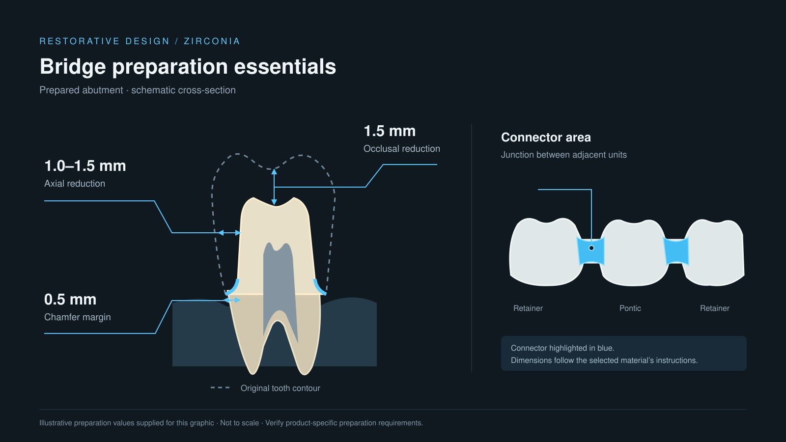 Zirconia bridge preparation and reduction guidelines diagram