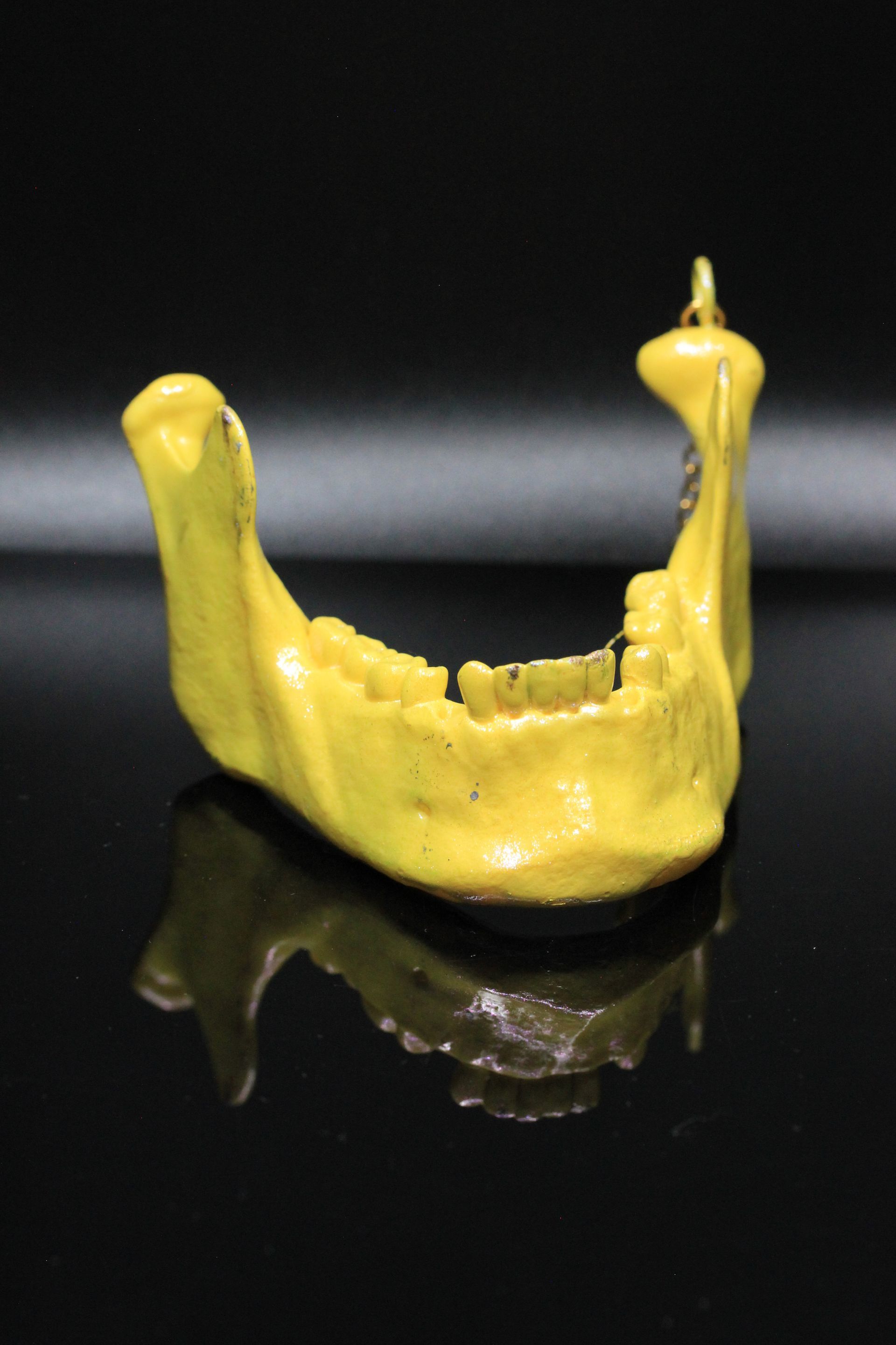 Child JawBone: Yellow