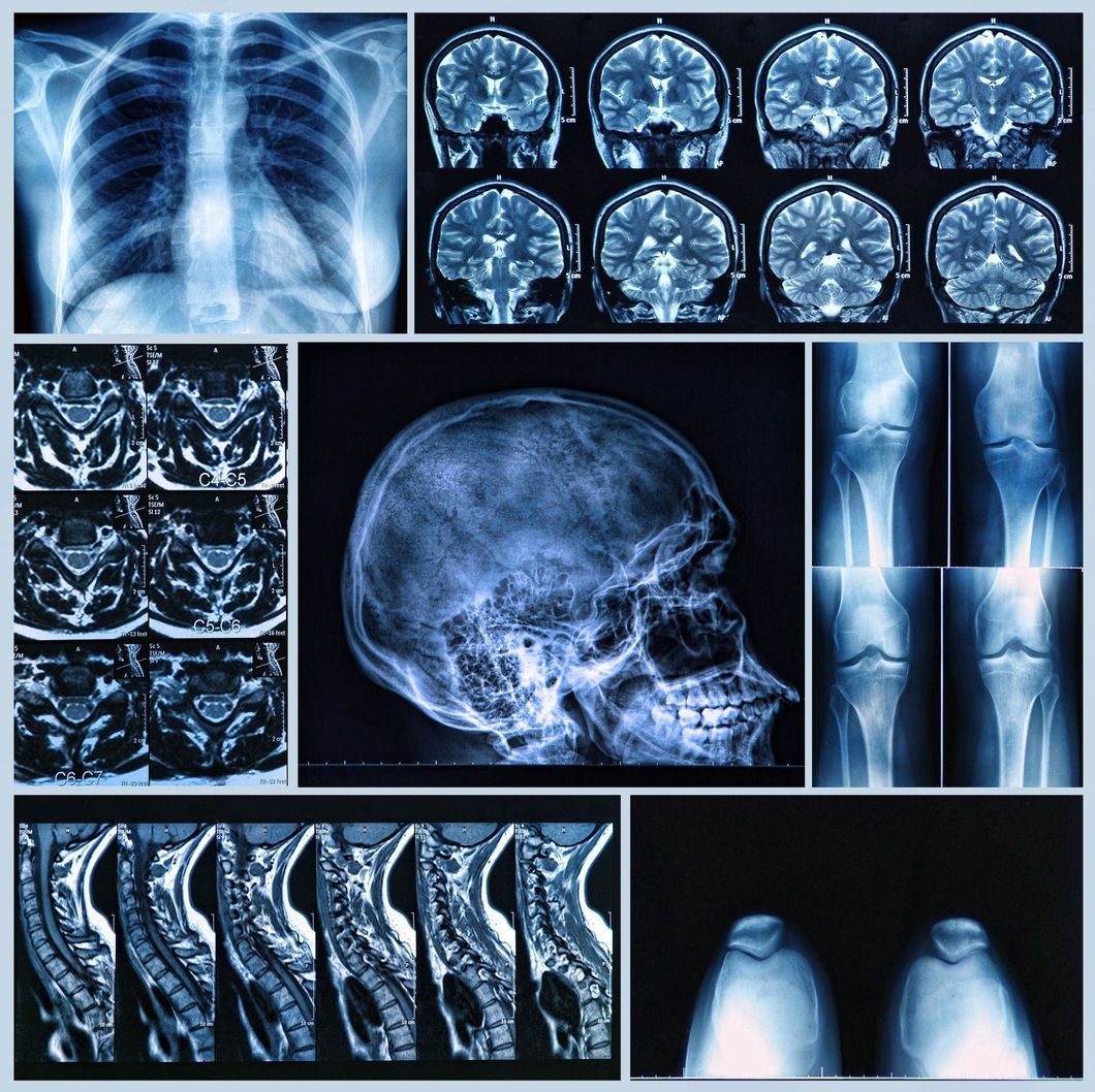 Collage di radiografie e risonanze magnetiche mediche con tonalità bluastra di torace, cervello, colonna vertebrale, cranio e gambe.
