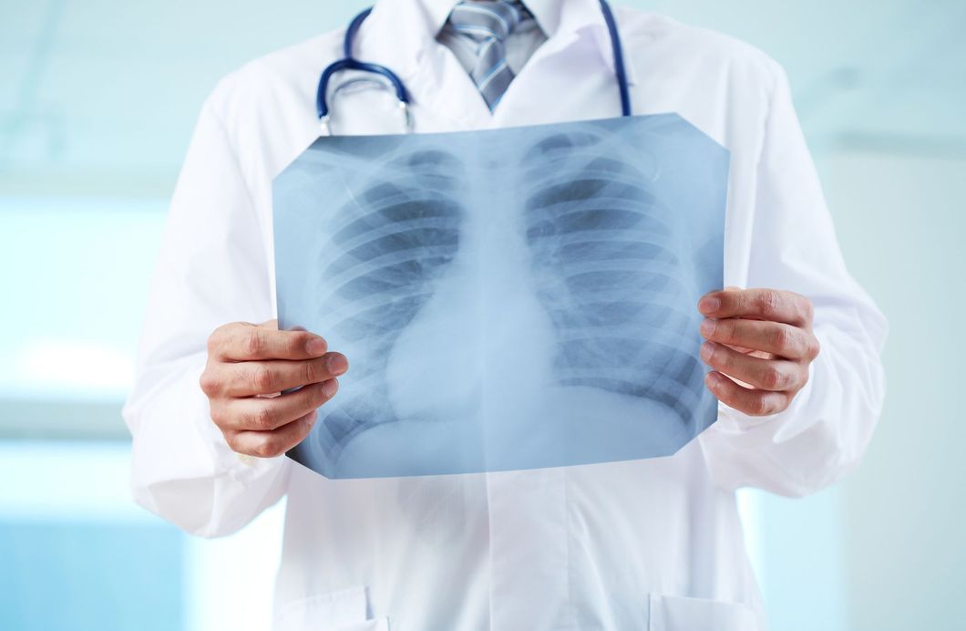 Un medico che tiene in mano una radiografia del torace in una clinica luminosa.