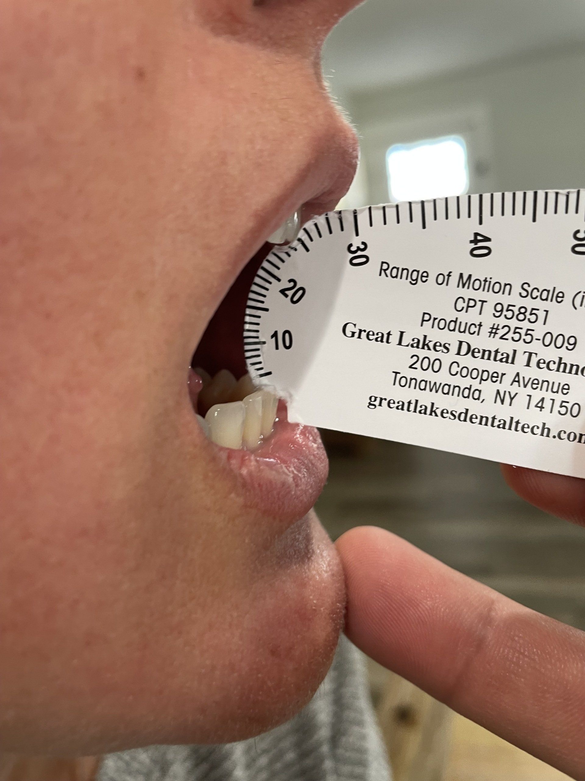 range of motion scale
