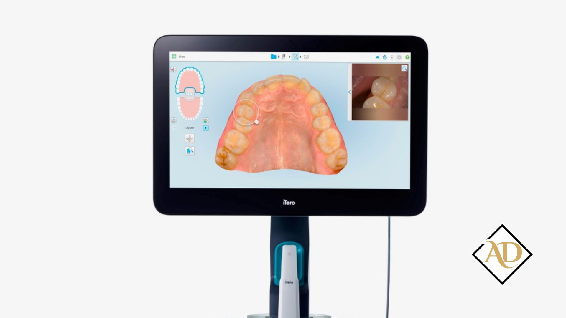 Dental scan displayed on a monitor showing upper teeth and palate, with a small inset camera view