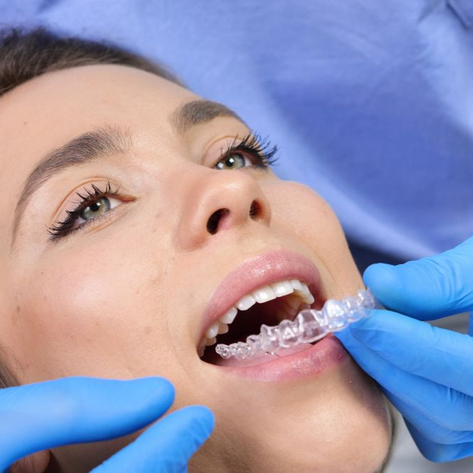 Person having clear aligner fitted in mouth by gloved hands.