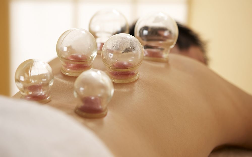Glass cupping therapy on a person's back; clear cups, reddish skin.