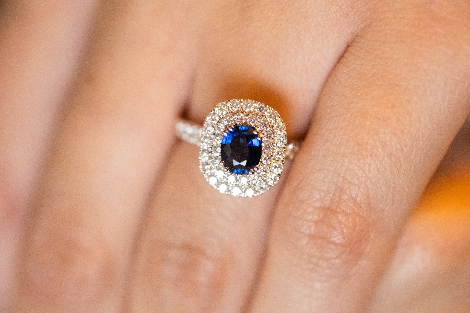 anello
