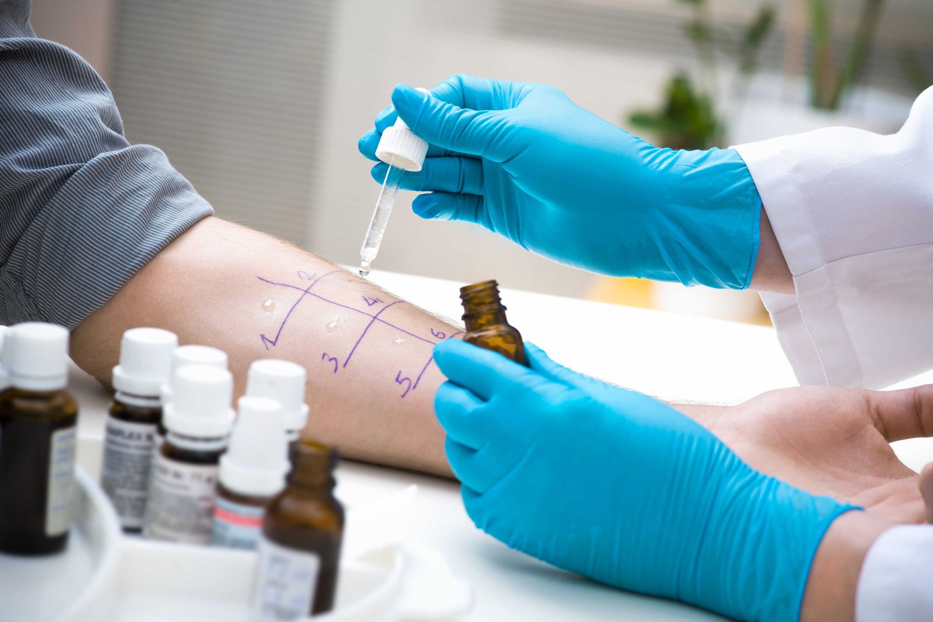 CLÍNICA DE ALERGIA E INMUNOLOGÍA ROMA-alergias y enfermedades inmunológicas