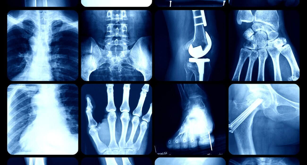 Dr. Carlos A. Jiménez Castro – Cirugía de: rodilla, cadera, hombro y brazo
