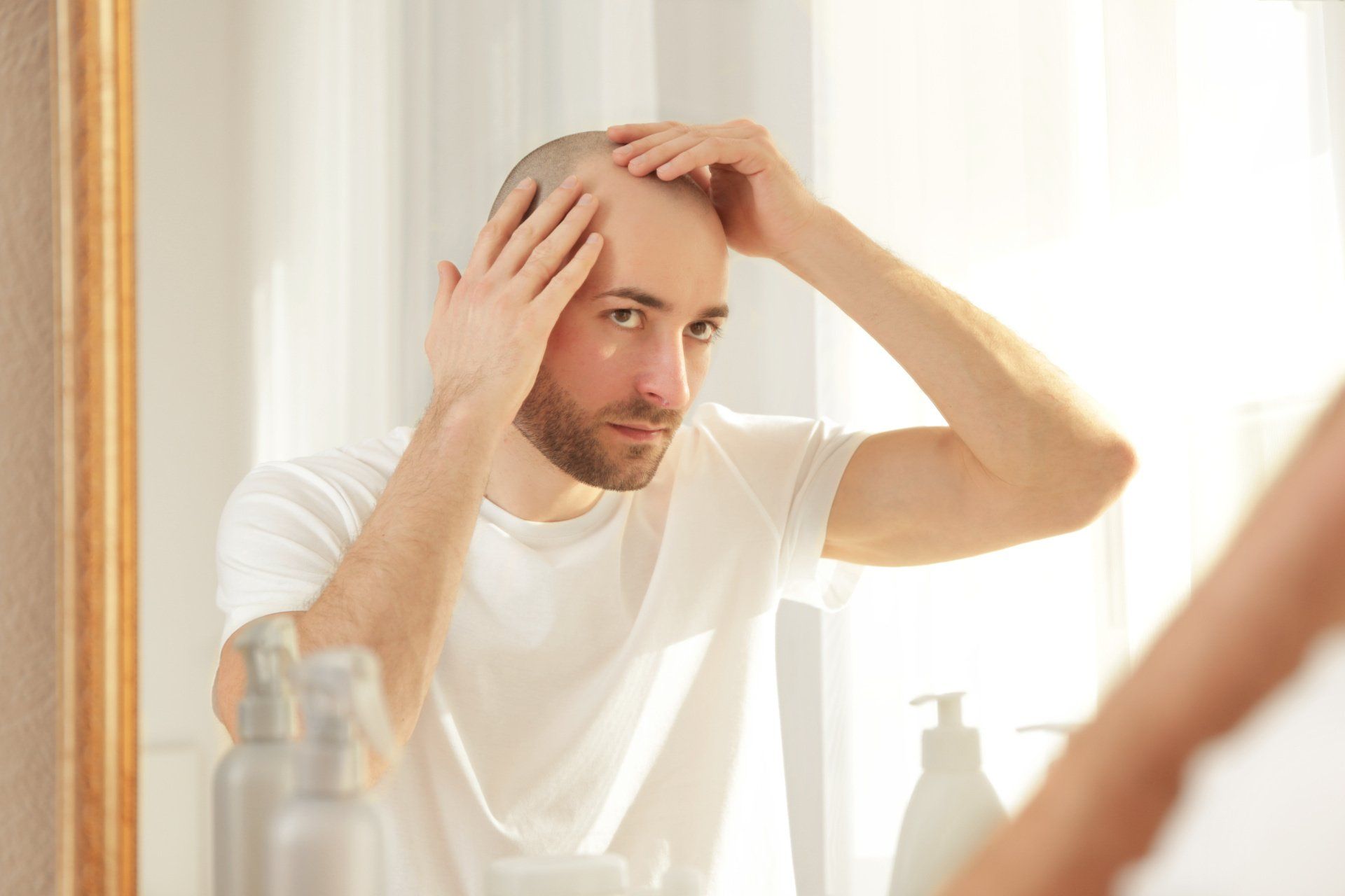 Quais são os tipos de alopecia capilar Quais são os tipos de alopecia capilar
