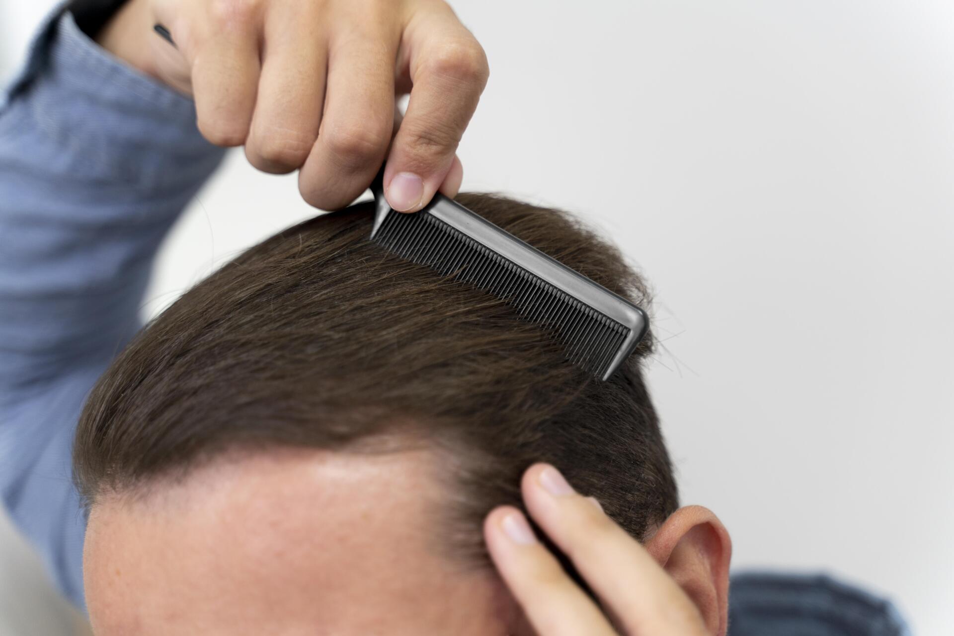 Tratamento para queda de cabelo Tratamento para queda de cabelo