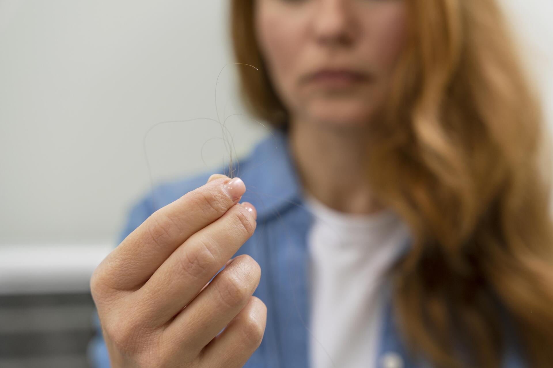 Diagnóstico para queda de cabelo Diagnóstico para queda de cabelo
