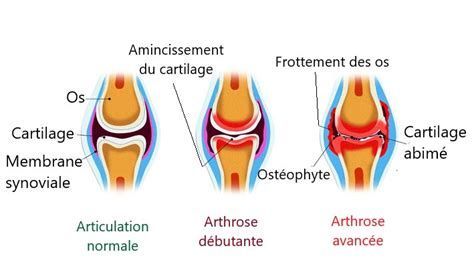 arthrose chat, mon chat a de l'arthrose, soigner arthrose chat , comment savoir si mon chat a de l'arthrose, clinique vétérinaire féline, vétérinaire pour chats, vétérinaire spécialiste du chat, médecine féline, clinique féline Lyon, vétérinaire chats Lyon, soins pour chats, clinique Cat Friendly Lyon, hôpital pour chats, bien-être félin, spécialiste chat Rhône, Entrechats Lyon, consultation vétérinaire chat, vétérinaire chat Lyon, mon chat et moi Lyon, mon chat et moi Rhône, vaccination chat Lyon, médecine féline, soins chat, vétérinaire félin Rhône, check-up chat, prévention santé chat, vétérinaire comportement chat, chat stressé vétérinaire, chat agressif vétérinaire, comportement félin, clinique Cat Friendly Lyon, bien-être félin, soins doux chat, apaiser chat, hospitalisation chat, chirurgie féline, anesthésie chat, soins post-opératoires chat, hôpital vétérinaire Rhône, clinique féline Lyon, surveillance vétérinaire chat, chirurgie douce chat, nutrition féline, alimentation chat, prévention maladies chat, conseils vétérinaires chat, suivi de poids chat, santé féline Lyon, vétérinaire nutrition chat,clinique Cat Friendly Lyon, équipe vétérinaire chats, vétérinaire félin Lyon, médecine du chat, bien-être félin, soins respectueux, spécialiste chat Lyon, conseils vétérinaires chat, blog chat, santé du chat, comportement félin, soins chat Lyon, prévention chat,