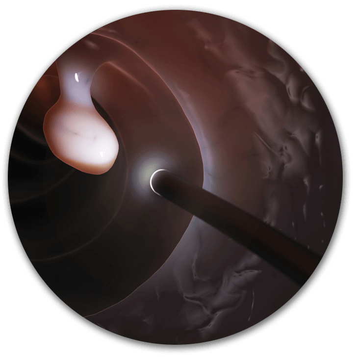 DR. ARMANDO FIGUEROA LABRA - COLONOSCOPIA