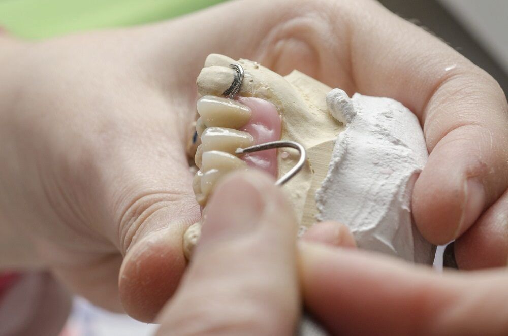 A Person Is Holding A Model Of A Tooth With A Hook On It — Highlands Denture Clinic in Willow Vale, NSW
