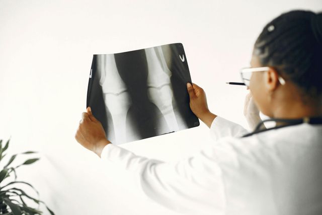 A doctor is looking at an x-ray of a knee.