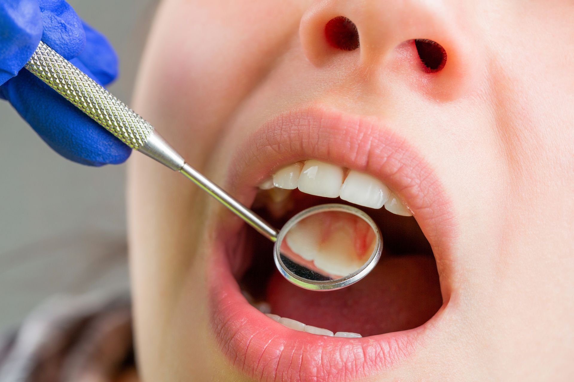 Woman having her teeth examined by a dentist Woman having her teeth examined by a dentist