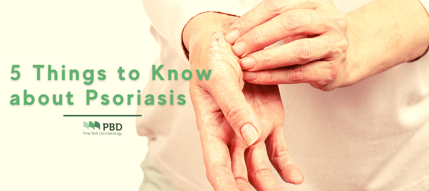 5 Things to Know About Psoriasis | Pine Belt Dermatology 5 Things to Know About Psoriasis | Pine Belt Dermatology