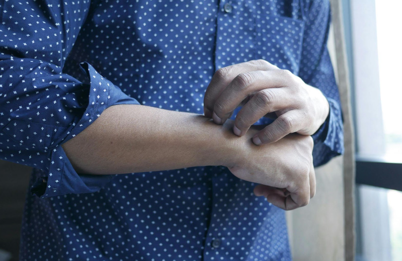 A Comprehensive Guide on Understanding and Managing Yeast Infections on the Skin | Pine Belt Dermatology