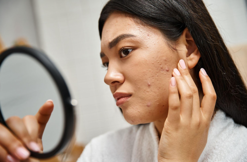 How Chlorine and Saltwater from Pools and Beaches Affect Your Skin and What to Do About It | Pine Belt Dermatology
