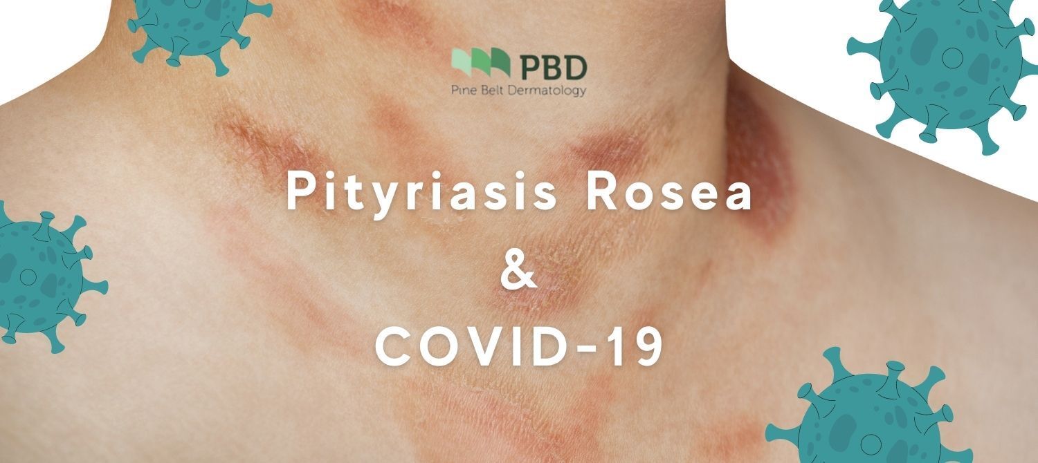 Pityriasis Rosea and Covid-19 Pityriasis Rosea and Covid-19