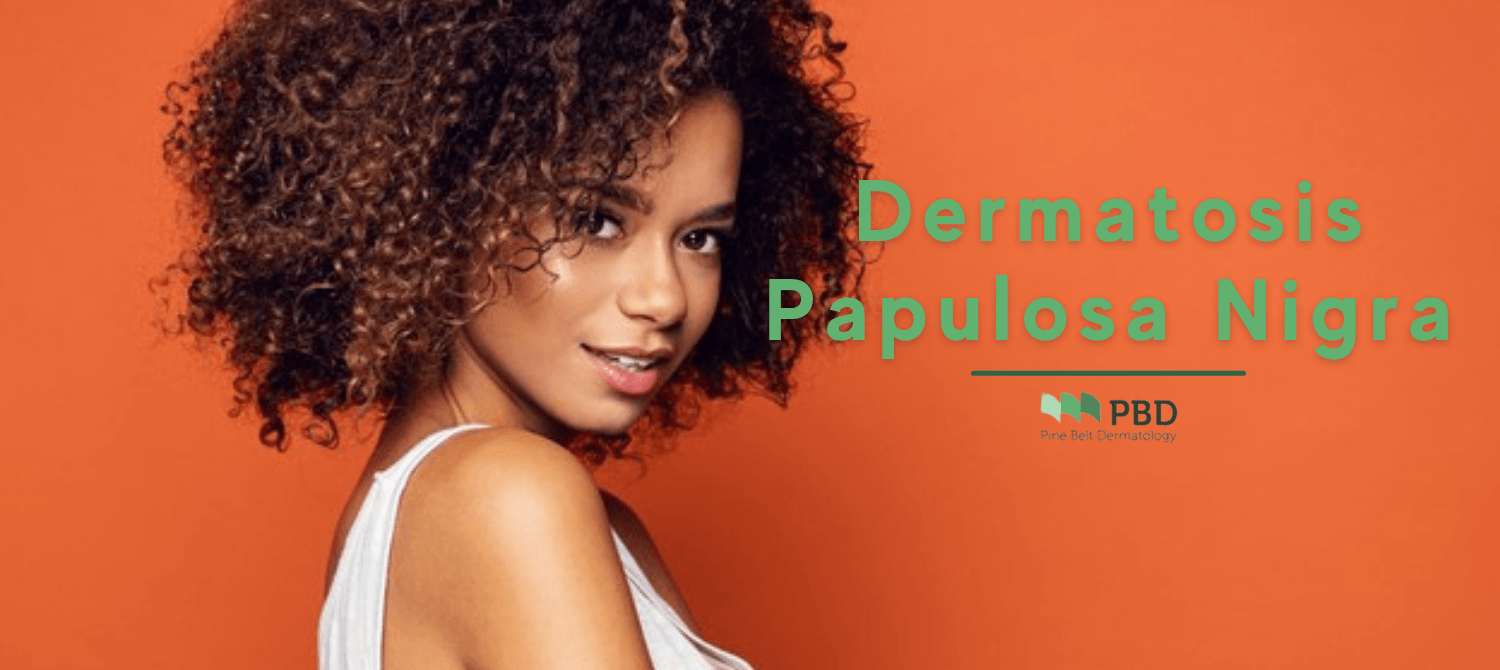 Papulosa Nigra | Pine Belt Dermatology