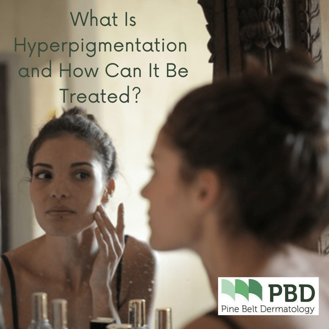 Hyperpigmentation | Pine Belt Dermatology