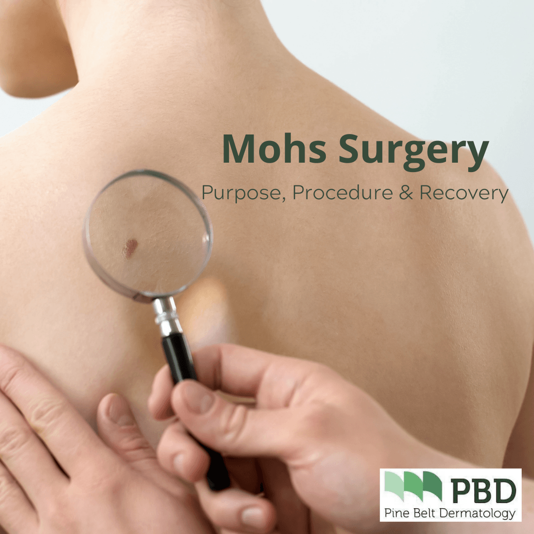 Purpose, Procedure and Recovery | Mohs Surgery | Pine Belt Dermatology