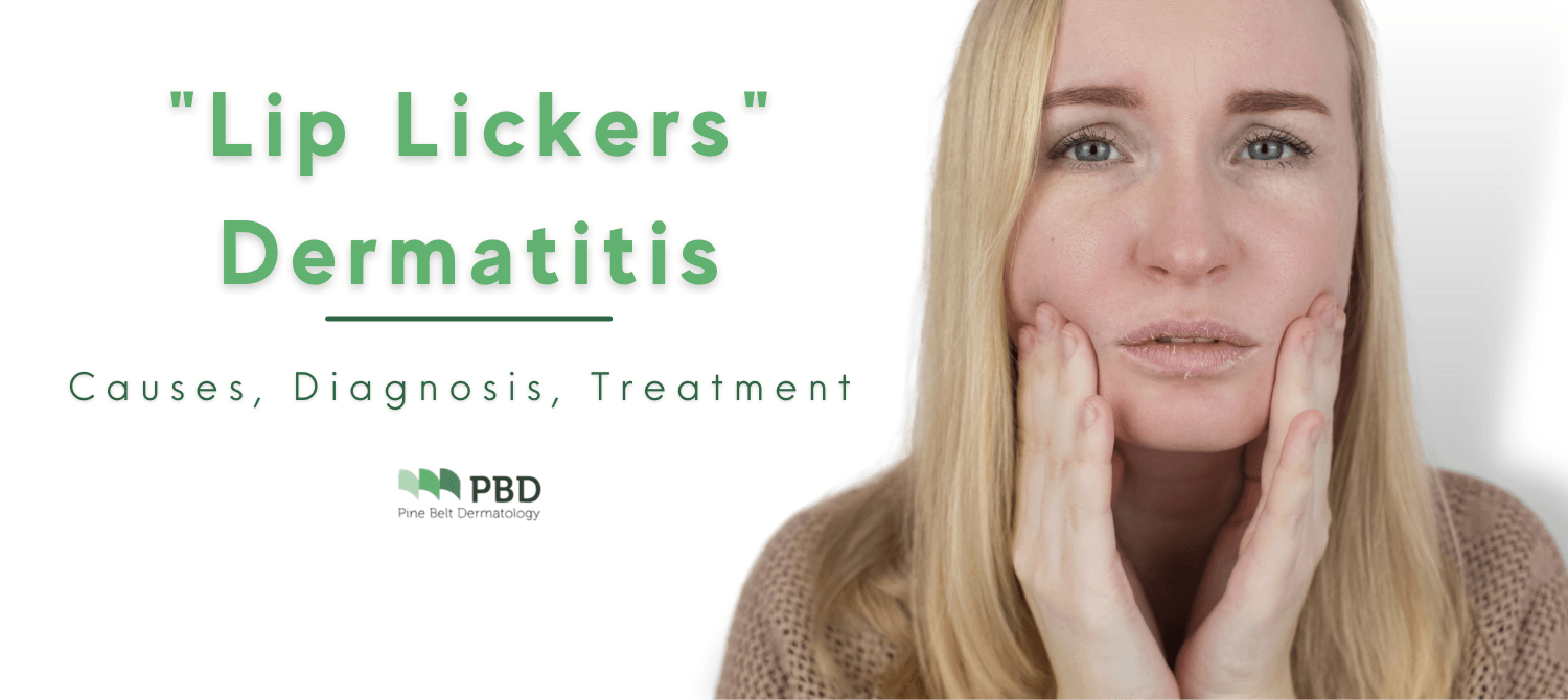 Woman with Lip Dermatitis