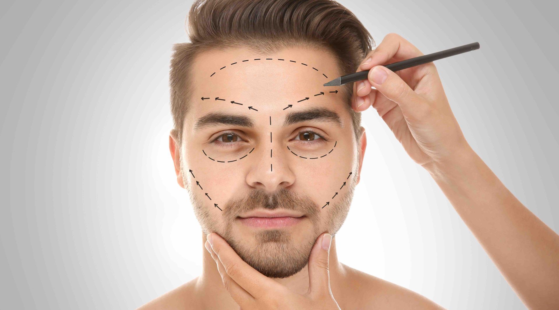 Gesicht für kosmetische Chirurgie markiert; gestrichelte Linien auf Stirn, Augen, Wangen und Kiefer. Hand hält Stift.