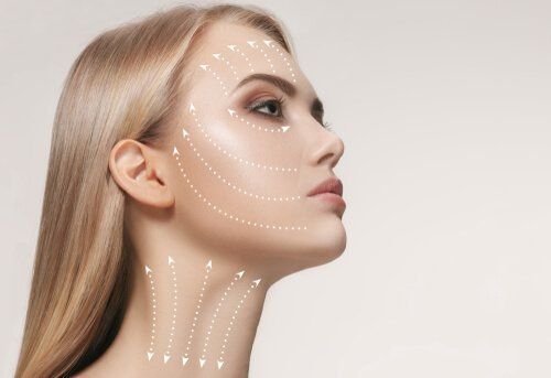 Visage de femme avec des lignes pointillées et des flèches indiquant les zones à traiter par des interventions esthétiques, vue de profil.
