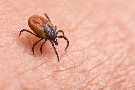 Tick on human skin, engorged, reddish-brown body with black legs, clinging.