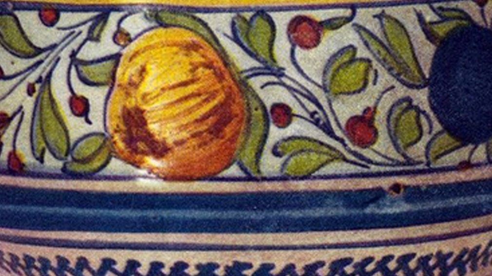 epilazione