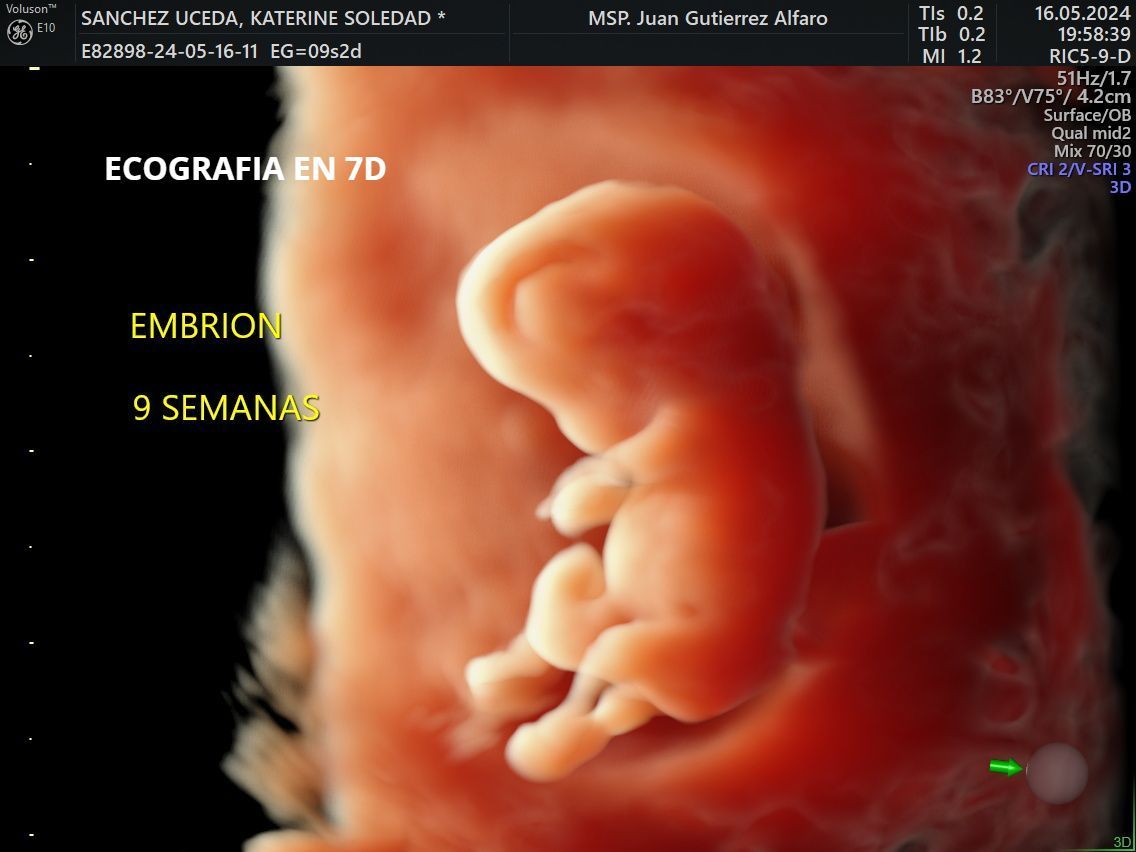 ECOGRAFIA 7 D