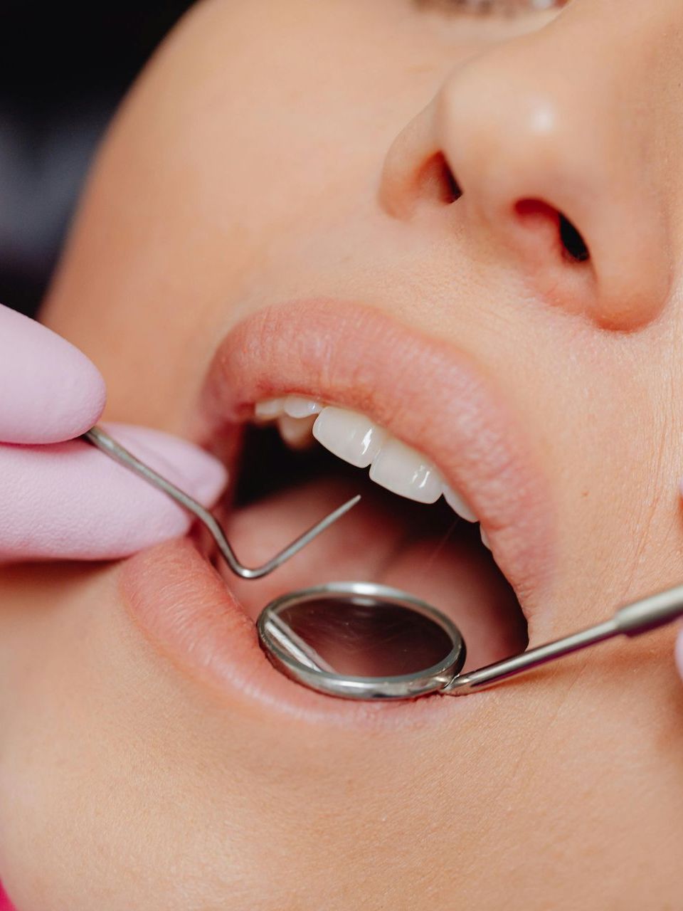 Dental Checkup