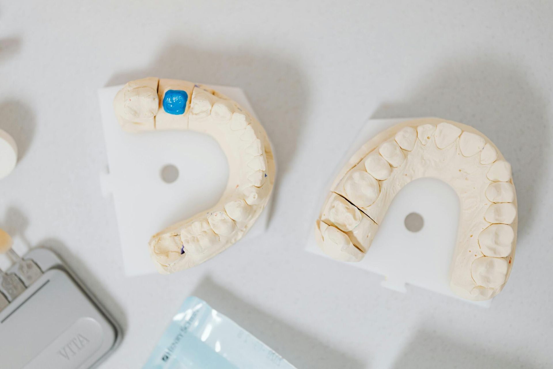 Dental plaster casts showing tooth impressions on a white surface with dental tools.
