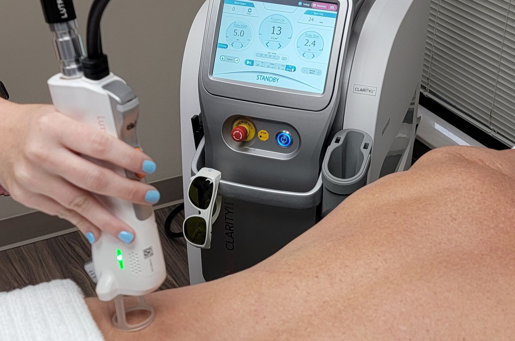 A man is getting a laser treatment on his face.